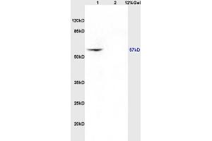 Lane 1: rat brain lysates Lane 2: rat kidney lysates probed with Anti CK4 Polyclonal Antibody, Unconjugated (ABIN730828) at 1:200 in 4 °C. (KRT4 Antikörper  (AA 256-360))