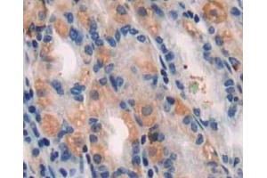 Used in DAB staining on fromalin fixed paraffin-embedded stomach tissue (TUBB1 Antikörper  (AA 166-451))