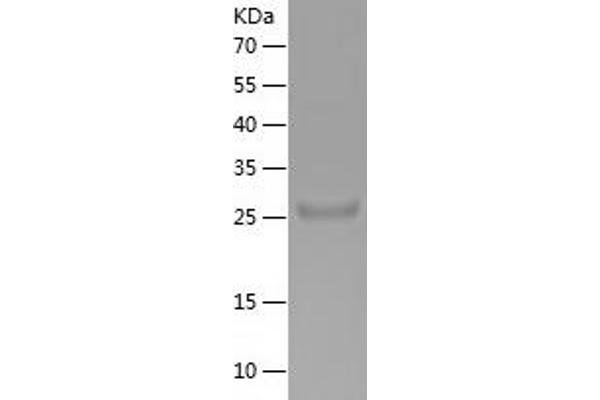 Thrombospondin 1 Protein (THBS1) (AA 19-265) (His tag)