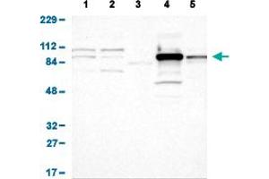 Western Blot analysis of (1) human cell line RT-4 (2) human cell line U-251MG sp (3) human plasma (IgG/HSA depleted) (4) human liver tissue, and (5) human tonsil tissue. (Glucose-6-Phosphate Dehydrogenase Antikörper  (AA 43-154))