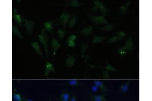 Immunofluorescence analysis of C6 cells using ZWINT Polyclonal Antibody at dilution of 1:100 (40x lens). (ZWINT Antikörper)