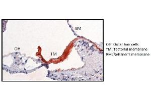 Immunohistological staining using SU-9D5 on paraffin sections of cochlea tissue of an adult transgenic mouse with a human CEACAM16 gene (Ceacam16+/+ mouse cochlea).