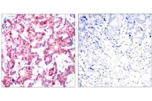 Image no. 1 for anti-GATA Binding Protein 1 (Globin Transcription Factor 1) (GATA1) (pSer142) antibody (ABIN196684) (GATA1 Antikörper  (pSer142))