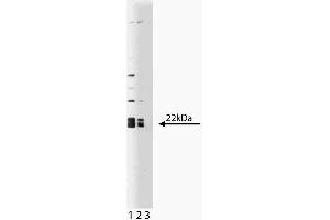 Western blot analysis of Caveolin 1 on a human endothelial lysate. (Caveolin-1 Antikörper  (AA 1-97))