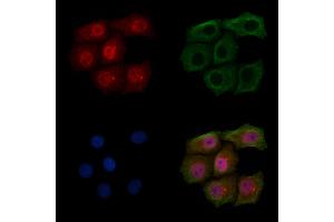 ABIN6254999 and ABIN6267500 staining HepG2 cells(4h of LPS treatment) by IF/ICC. (BRCA1 Antikörper  (pSer1524))