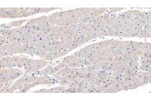 Detection of MYOC in Human Cardiac Muscle Tissue using Polyclonal Antibody to Myocilin (MYOC) (MYOC Antikörper  (AA 224-471))