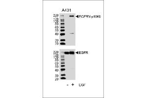 Western blot analysis of lysates from A431 cell line, untreated or treated with EGF, 100 ng/mL, using EGFRY Antibody (p1069) (ABIN1881283 and ABIN2839662) (upper) or EGFR (lower). (EGFR Antikörper  (pTyr1069))