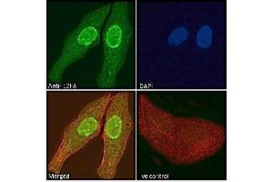 ABIN570707 Immunofluorescence analysis of paraformaldehyde fixed U2OS cells, permeabilized with 0.