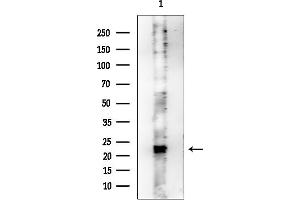 anti-Mitochondrial Ribosomal Protein L50 (MRPL50) (C-Term) antibody