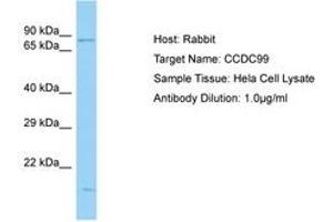 Image no. 1 for anti-Protein Spindly (SPDL1) (C-Term) antibody (ABIN6750167) (Spindly Antikörper  (C-Term))