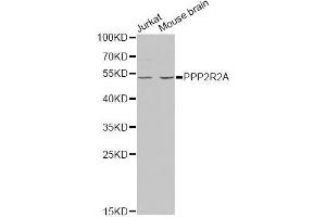Western blot analysis of extracts of various cell lines, using PPP2R2A antibody (ABIN5971211) at 1/1000 dilution. (PPP2R2A Antikörper)