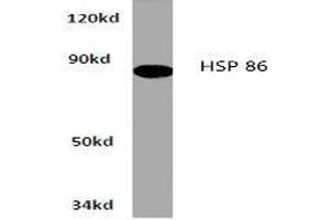 Image no. 1 for anti-Heat Shock Protein 90kDa alpha (Cytosolic), Class A Member 1 (HSP90AA1) antibody (ABIN265473) (HSP90AA1 Antikörper)