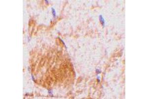 Immunohistochemistry of Il31 in rat skeletal muscle tissue with Il31 polyclonal antibody  at 10 ug/mL . (IL-31 Antikörper  (N-Term))