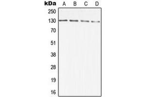Western blot analysis of DIAPH2 expression in A431 (A), HCT116 (B), SP2/0 (C), PC12 (D) whole cell lysates.