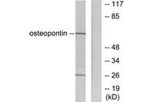 Western blot analysis of extracts from LOVO cells, using Osteopontin Antibody. (Osteopontin Antikörper  (AA 261-310))