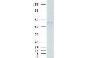 Validation with Western Blot