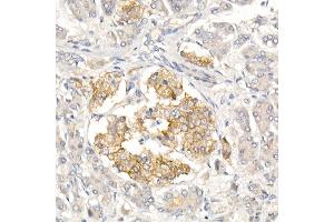 Immunohistochemistry of paraffin-embedded Human islet using CD99 Rabbit pAb (ABIN3022730, ABIN3022731, ABIN3022732, ABIN1512728 and ABIN6219199) at dilution of 1:50 (40x lens).