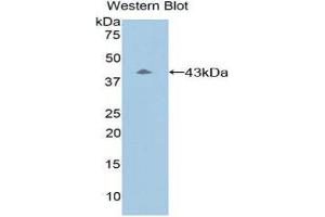 Western Blotting (WB) image for anti-Complement Component 8, beta Polypeptide (C8B) (AA 161-503) antibody (ABIN3206898)