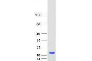 Validation with Western Blot (MED10 Protein (Myc-DYKDDDDK Tag))