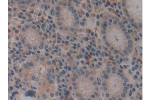 Immunohistochemistry (IHC) image for anti-Pre-B Lymphocyte 1 (VPREB1) (AA 33-135) antibody (ABIN2118836)