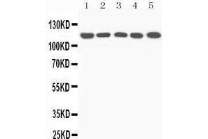 Western Blotting (WB) image for anti-Complement Component 5 (C5) (AA 1-18), (N-Term) antibody (ABIN3044294) (C5 Antikörper  (N-Term))
