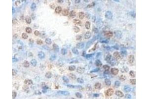 Immunohistochemical analysis of paraffin-embedded human fetal kidney showing cytoplasmic staining with ABHD12B polyclonal antibody  at a 1 : 100 dilution. (ABHD12B Antikörper  (AA 78-284))