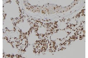 ABIN6277110 at 1/100 staining Rat lung tissue by IHC-P. (TYK2 Antikörper  (C-Term))