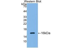 Western blot analysis of the recombinant protein. (SFRP5 Antikörper  (AA 48-165))