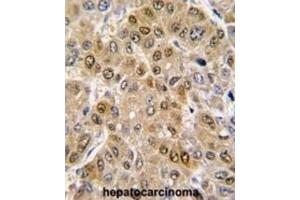 Immunohistochemistry (IHC) image for anti-DEAD (Asp-Glu-Ala-Asp) Box Polypeptide 5 (DDX5) (AA 491-518) antibody (ABIN3003228) (DDX5 Antikörper  (AA 491-518))