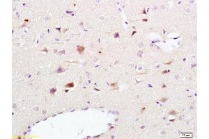 Formalin-fixed and paraffin embedded rat brain tissue labeled Anti-NCAM1 Polyclonal Antibody, Unconjugated  at 1:200, followed by conjugation to the secondary antibody and DAB staining (CD56 Antikörper  (AA 701-800))