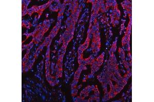 IF analysis of TOMM20 using anti-TOMM20 antibody (ABIN7600883). (TOMM20 Antikörper  (AA 25-145))