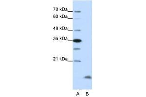Western Blot showing CCNB3 antibody used at a concentration of 1-2 ug/ml to detect its target protein. (Cyclin B3 Antikörper  (N-Term))