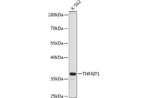 Western blot analysis of extracts of K-562 cells, using TNF antibody (ABIN7271074) at 1:1000 dilution. (TNFAIP1 Antikörper  (AA 90-160))