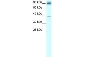 WB Suggested Anti-NFKB2 Antibody Titration:  0. (NFKB2 Antikörper  (C-Term))