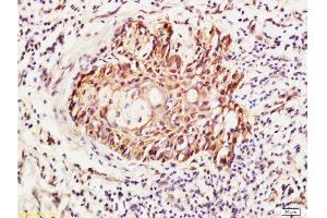 Formalin-fixed and paraffin embedded human skin labeled with Anti-RhoA Polyclonal Antibody , Unconjugated 1:400 followed by conjugation to the secondary antibody and DAB staining (RhoA, C (AA 101-193) Antikörper)