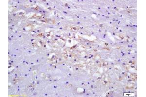 Formalin-fixed and paraffin embedded rat brain tissue labeled Anti-Ets1/ETS-1 Polyclonal Antibody, Unconjugated (ABIN674424) at 1:200, followed by conjugation to the secondary antibody and DAB staining (ETS1 Antikörper  (AA 321-441))