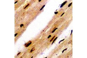 Immunohistochemical analysis of PSMB8 staining in rat heart formalin fixed paraffin embedded tissue section.