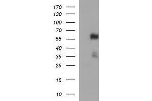 Western Blotting (WB) image for anti-Tubulin, alpha 1B (TUBA1B) antibody (ABIN2715958) (TUBA1B Antikörper)