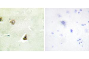 Peptide - + (DUSP6 Antikörper)