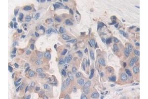 Immunohistochemistry (IHC) image for anti-Fucosyltransferase 4 (Alpha (1,3) Fucosyltransferase, Myeloid-Specific) (FUT4) (AA 264-497) antibody (ABIN7433084)