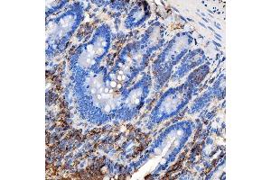 IHC analysis of RAB7/RAB7A using anti-RAB7/RAB7A antibody (ABIN7600597).