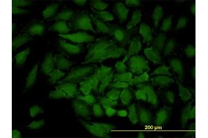 Immunofluorescence of monoclonal antibody to GJB3 on HeLa cell. (Connexin 31 Antikörper  (AA 1-270))