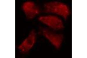 ABIN6274152 staining A549 cells by IF/ICC. (Histone H1 Antikörper  (Internal Region))