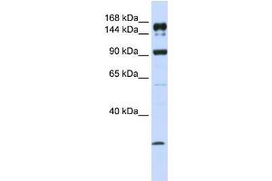Human MCF-7; WB Suggested Anti-ABCA5 Antibody Titration: 1 ug/ml. (ABCA5 Antikörper  (C-Term))