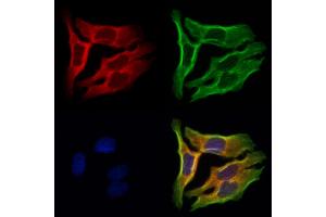 ABIN6262116 and ABIN6273047 staining Hela cells by IF/ICC. (GSTA4 Antikörper  (N-Term))