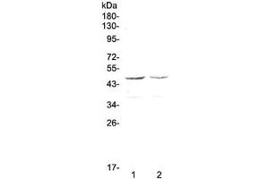 Western blot testing of human 1) HepG2 and 2) MCF7 cell lysate with GALT antibody at 0. (GALT Antikörper)