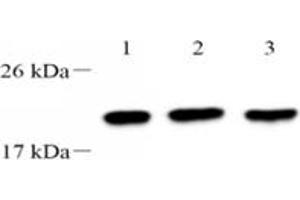 Western blot analysis of TPPP3 (ABIN7076047),at dilution of 1: 2000,Lane 1: 293 cell lysate,Lane 2: PC3 cell lysate,Lane 3: A549 cell lysate (TPPP3 Antikörper)