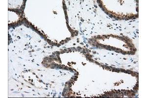 Immunohistochemical staining of paraffin-embedded Human prostate tissue using anti-ACAT2 mouse monoclonal antibody.
