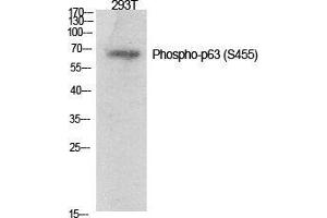Western Blot (WB) analysis of specific cells using Phospho-p63 (S455) Polyclonal Antibody. (TCP1 alpha/CCTA Antikörper  (pSer455))
