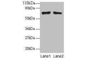 Western blot All lanes: BMI1 antibodyt 2 μg/mL Lane 1: EC109 whole cell lysate Lane 2: 293T whole cell lysate Secondary Goat polyclonal to rabbit IgG at 1/15000 dilution Predicted band size: 37 kDa Observed band size: 70 kDa (BMI1 Antikörper  (AA 1-247))